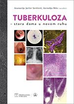 Tuberkuloza